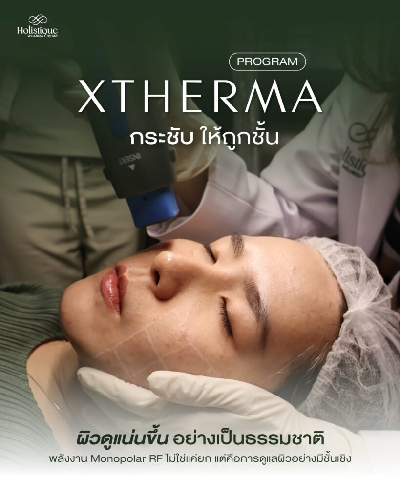 Xtherma ยกกระชับที่ตอบโจทย์