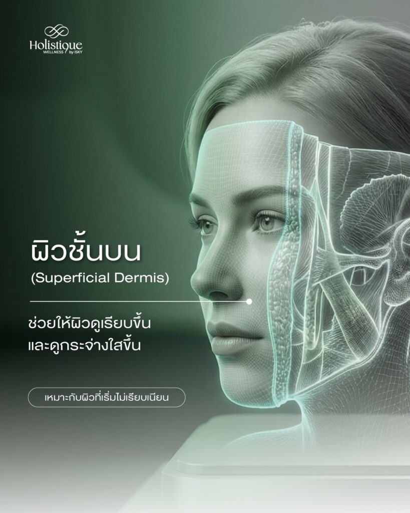 Xtherma ยกกระชับที่ตอบโจทย์