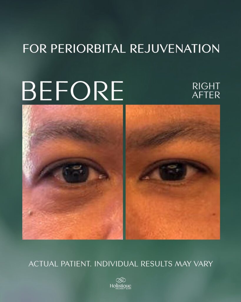 Regenerative Aesthetics เมื่อการดูแลผิวก้าวไปไกลกว่าการเติมเต็ม